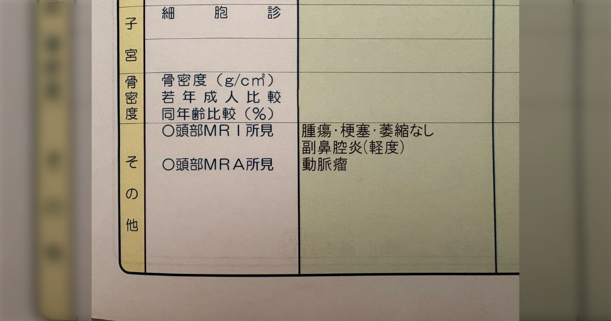 夫と喧嘩したときに「頭おかしーんじゃないん‼️検査しろ‼️」と言ったら、本当に脳ドックを申し込んで受診、動脈瘤が見つかった…ただの悪口なのに「見つかってよかった」