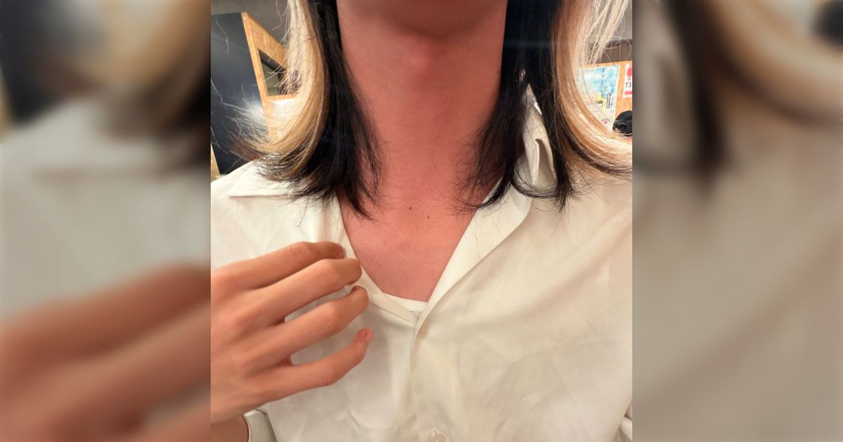 「まじでトラウマになりそう」アレルギーなので、店でノンアルコールの男梅ソーダを頼んだのに、飲んだら症状が出て再確認したら梅酒ソーダだった… その後電話したら、またしても信じられない対応