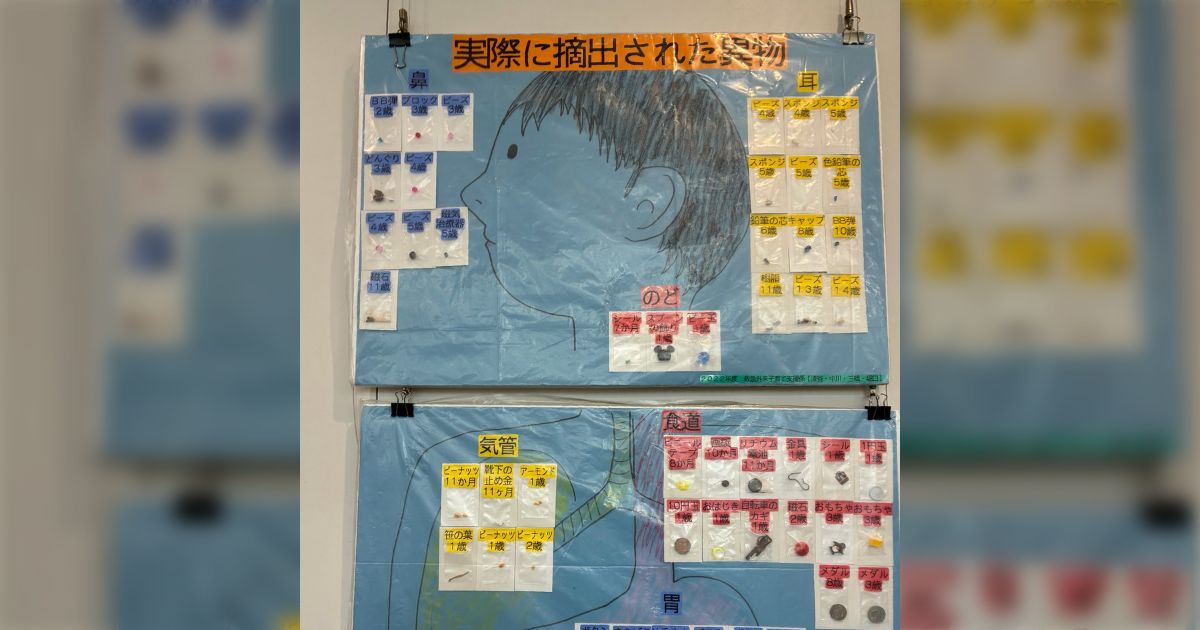 病院に貼り出されてた、子どもの体から実際に摘出された異物がリアルで怖い「胃がバケモン揃い」「13、14歳って中学生よね?」